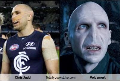 Chris Judd Totally Looks Like Voldemort
