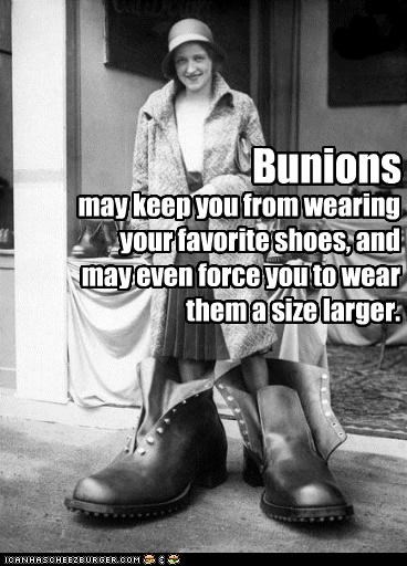Bunions Aren't A Girl's Best Friend...