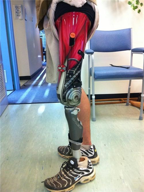Bionic Man Of The Day