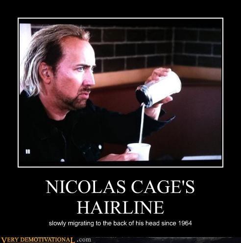 NICOLAS CAGE'S HAIRLINE