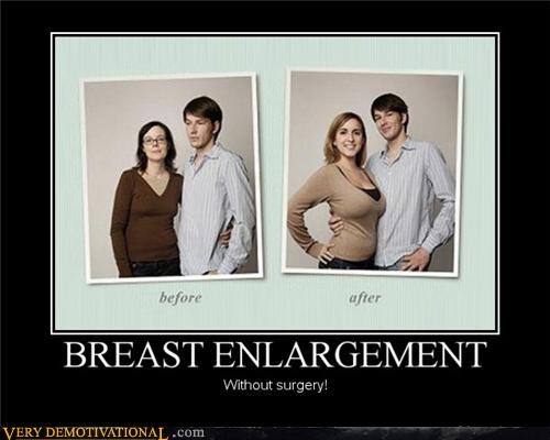 BREAST ENLARGEMENT