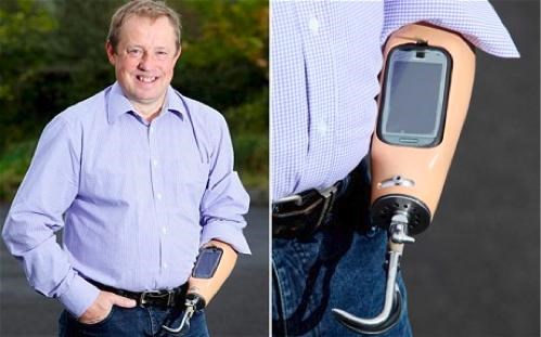 Prosthetic Smartphone Arm of the Day