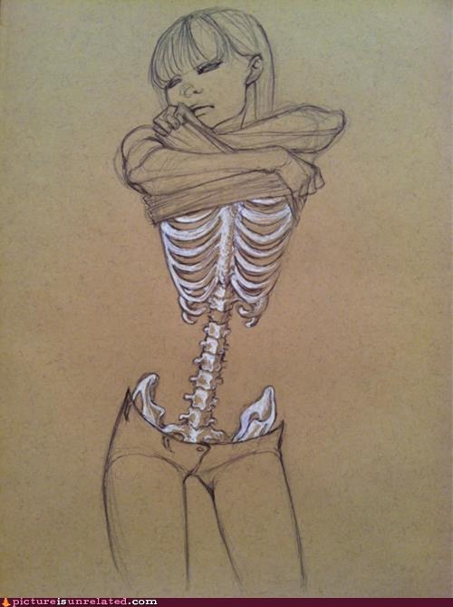 Serious Eating Disorder