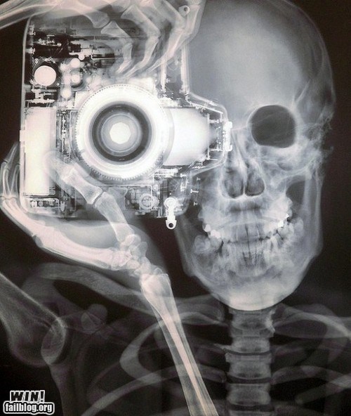WIN!: X-Ray WIN