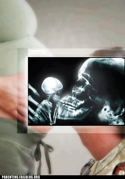 Flesh and Bones