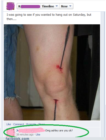 I Took a Tattoo to the Leg