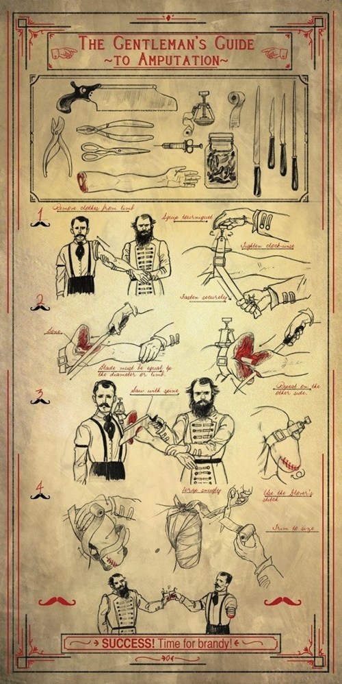 Old Timey Amputation