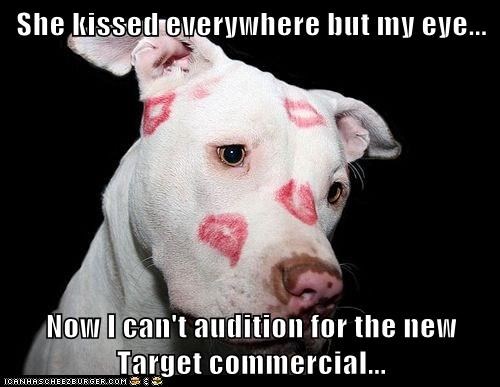 She kissed everywhere but my eye...  Now I can't audition for the new Target commercial...