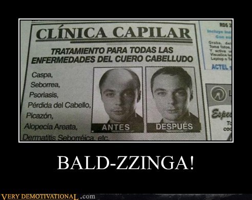 BALD-ZZINGA!