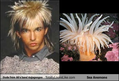 Limahl (Kajagoogoo) Totally Looks Like Sea Anemone