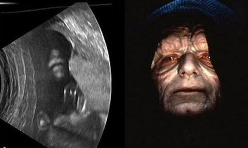 We're Having a Baby! It's a Sith!
