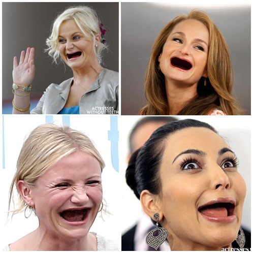Single Topic Blog of the Day: Actresses Without Teeth