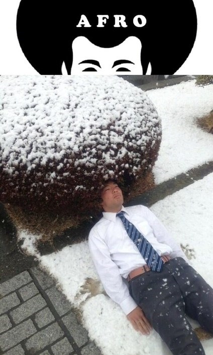 Looks Like Someone's Got a Dandruff Problem