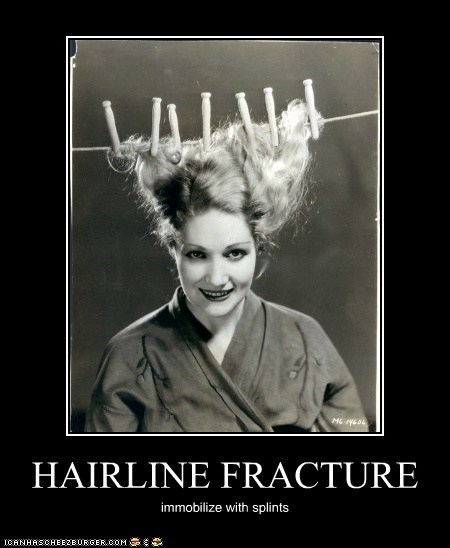 HAIRLINE FRACTURE