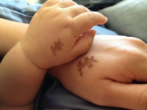 Tattoo of Her Child's Birthmark