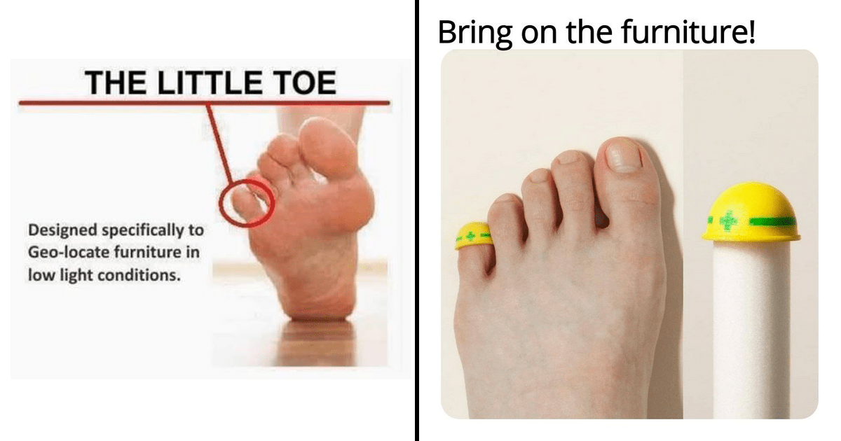 If this toe could talk; what would it say? : r/funny