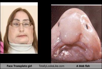 Face Transplate girl Totally Looks Like A blob fish ...