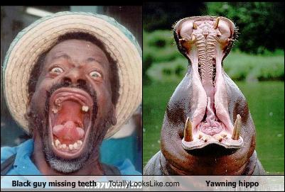 Free Dating Sites >> Black guy missing teeth Totally Looks Like Yawning hippo - Cheezburger - Funny Memes | Funny ... Free Dating Sites >> Black guy missing teeth Totally Looks Like Yawning hippo - Cheezburger - Funny Memes | Funny ...