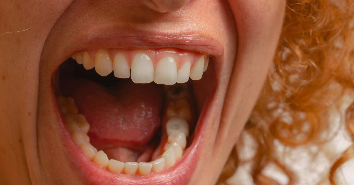 16-year-old screams at her aunt for mixing her potatoes, meat, and salad together at a restaurant: 'The rest of the meal was awkward.'