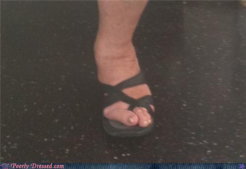 hammer toe flip flops