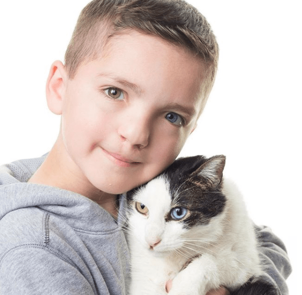 This Bullied Boy's Life Changed After He Adopted A Cat With Same Rare 