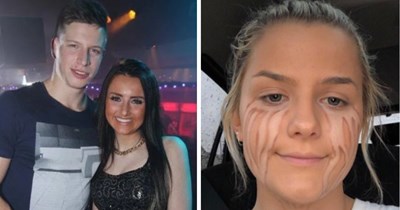 20 Fake Tan Fails That Took “Glow Up” Way Too Literally