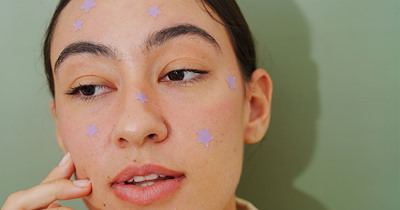 Recruiter begs Gen-Z professionals to stop wearing stickers on their face during job interviews: 'The hiring manager is 47. She does not know those are pimple patches.'